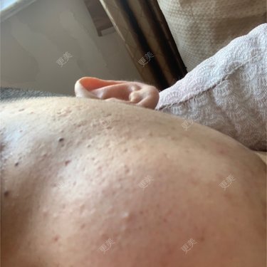 皮肤综合管理套餐