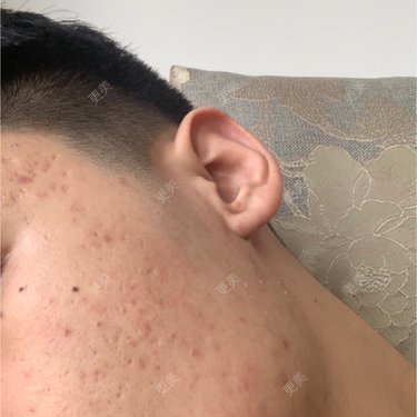 皮肤综合管理套餐