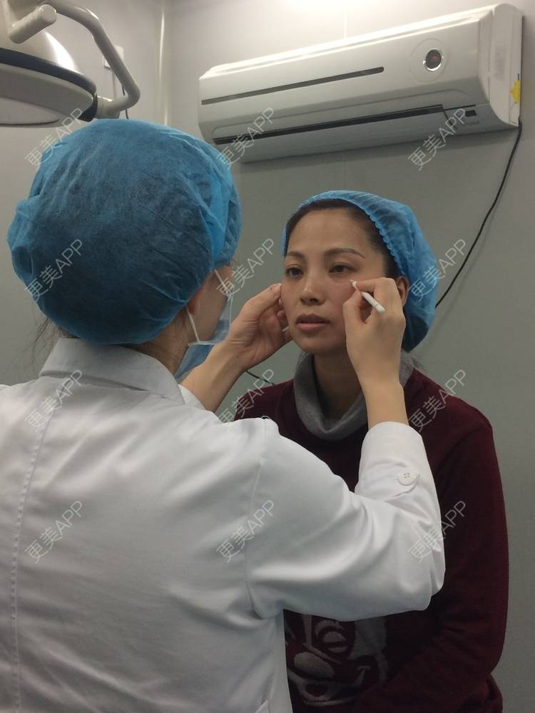 更美 - 更美用户EWi3oovLr0的射频提升经验 | 武汉 | 射频提升