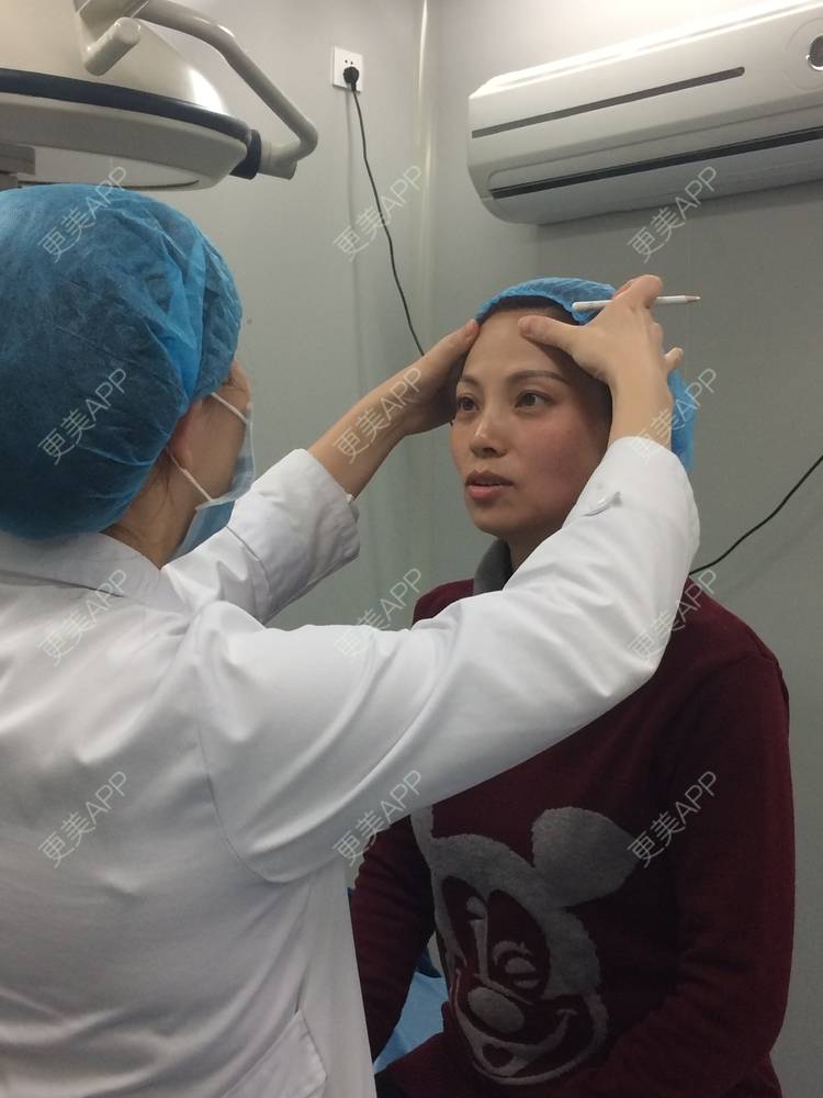 更美 - 更美用户EWi3oovLr0的射频提升经验 | 武汉 | 射频提升