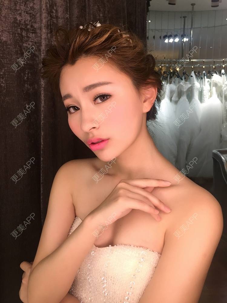 更美 - YOYO球的镭射净肤经验 | 镭射净肤 | 广州