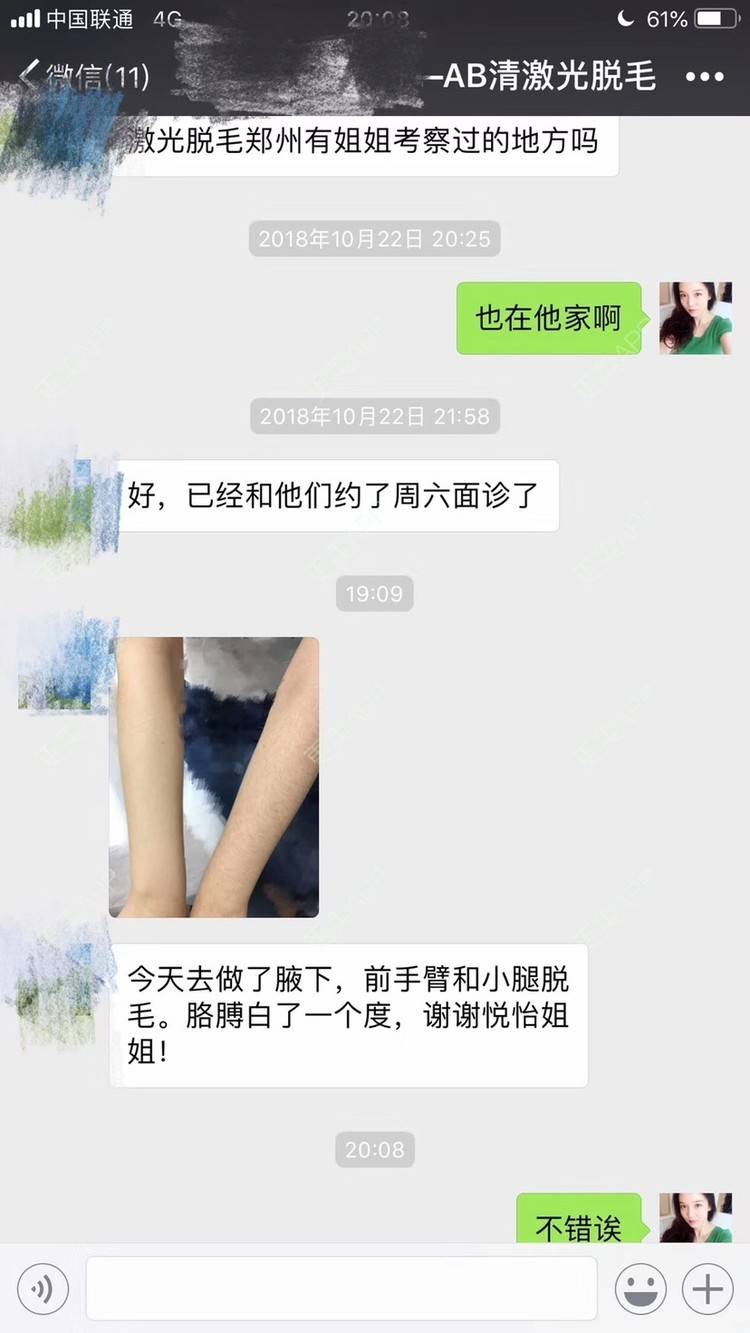 更美 - 悦怡姐姐的手臂脱毛经验 | 手臂脱毛 | 大腿脱毛 | 上海