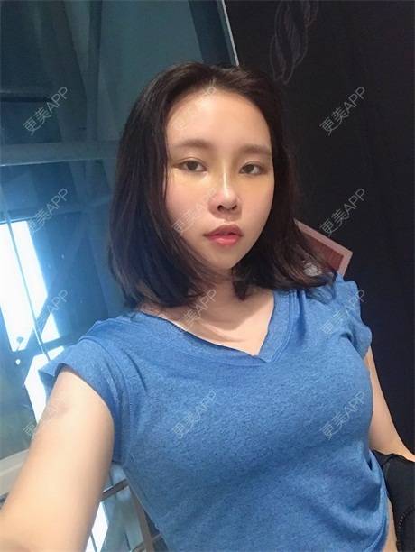 零时差绷栏的丰胸隆胸日记