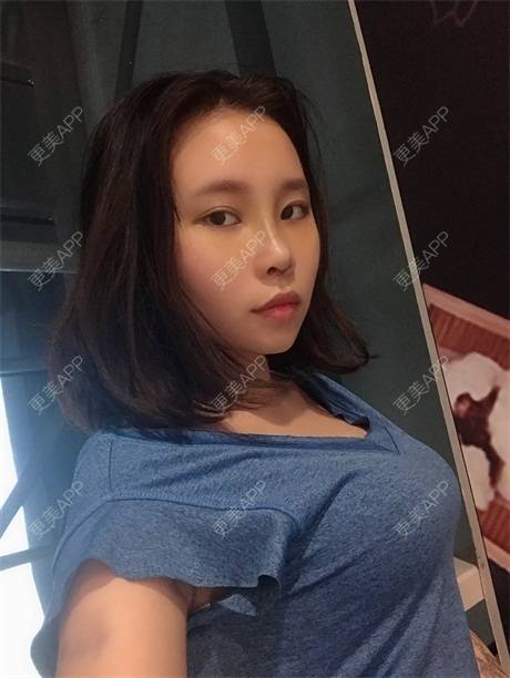 零时差绷栏的丰胸隆胸日记