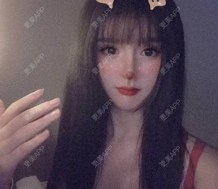 更美 - 老街上的猫的吸脂瘦脸经验 | 南昌 | 视频日记 | 吸脂瘦脸