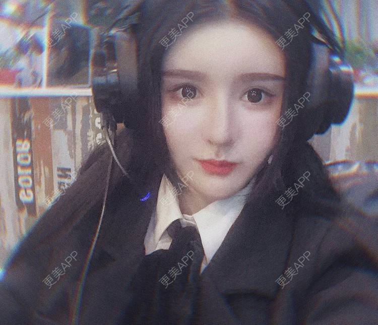 更美 - 老街上的猫的吸脂瘦脸经验 | 南昌 | 视频日记 | 吸脂瘦脸