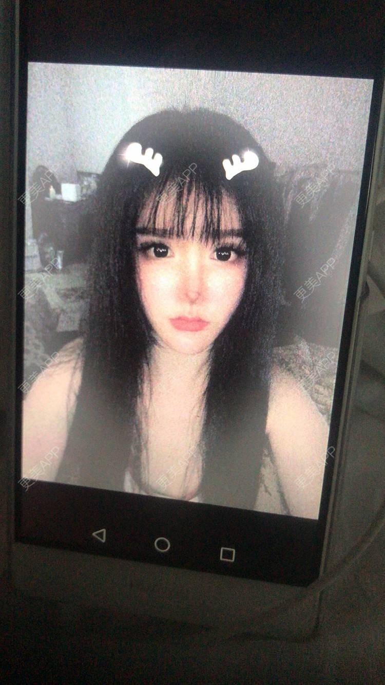 更美 - 老街上的猫的吸脂瘦脸经验 | 南昌 | 视频日记 | 吸脂瘦脸