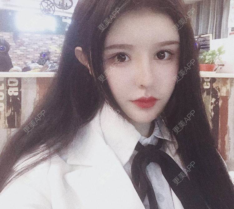 更美 - 老街上的猫的吸脂瘦脸经验 | 南昌 | 视频日记 | 吸脂瘦脸