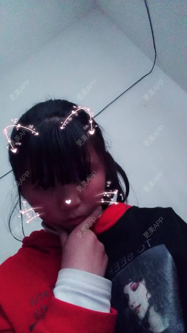 更美 - 更美用户I52BjrWqjJ的定点双眼皮经验 | 定点双眼皮 | 肋软骨隆鼻 | 额头缩小 | 假体丰臀 | 激光淡斑 | 毕节
