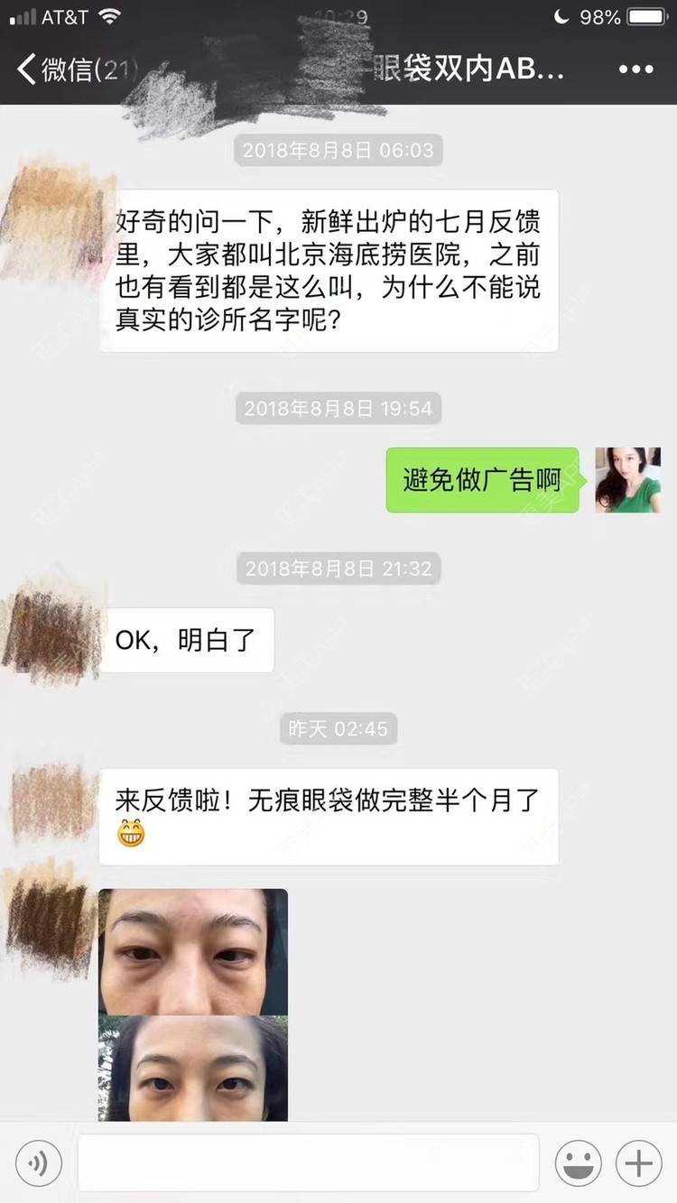 更美 - 悦怡姐姐的激光去眼袋经验 | 激光去眼袋 | 上海