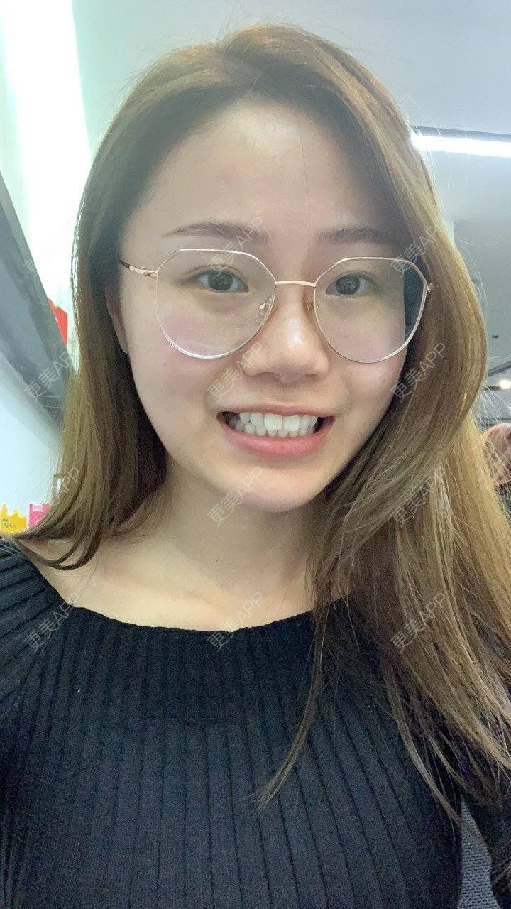 更美 - ahah的牙齿矫正经验 | 牙齿矫正 | 广州