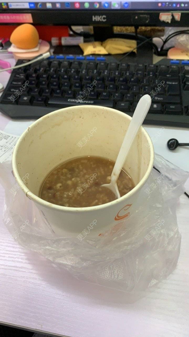 更美 - ahah的牙齿矫正经验 | 牙齿矫正 | 广州