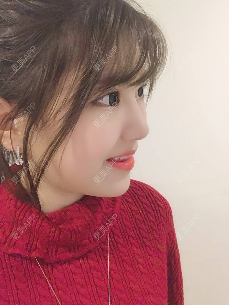 更美 - 更美用户Zxz1XIEMyn的经验 | 上海