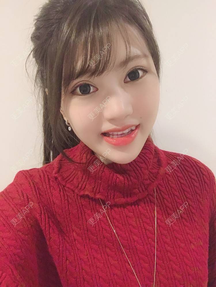 更美 - 更美用户Zxz1XIEMyn的经验 | 上海