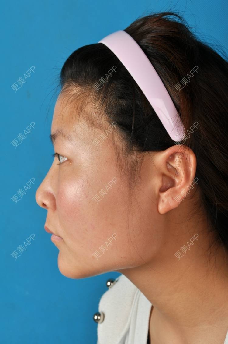 更美用户4tv8lb3bvz的下颌角日记