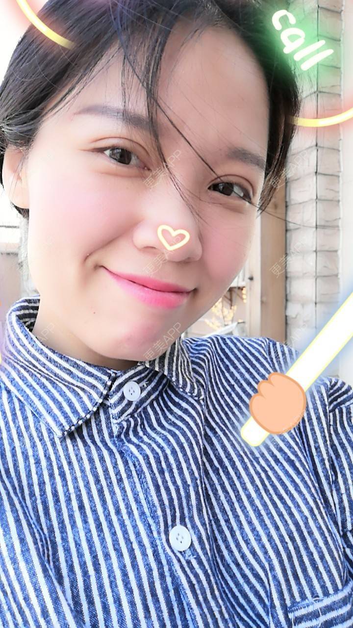 更美 - 更美用户5Pz3SpoBlS的果酸焕肤经验 | 果酸焕肤 | 济南