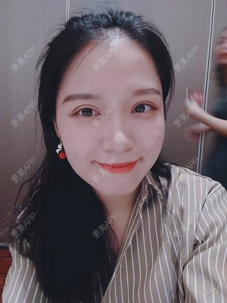 更美 - 更美用户5Pz3SpoBlS的果酸焕肤经验 | 果酸焕肤 | 济南