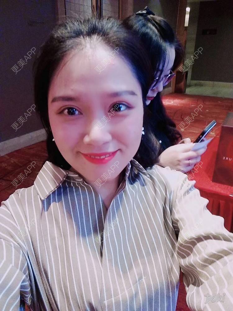 更美 - 更美用户5Pz3SpoBlS的果酸焕肤经验 | 果酸焕肤 | 济南