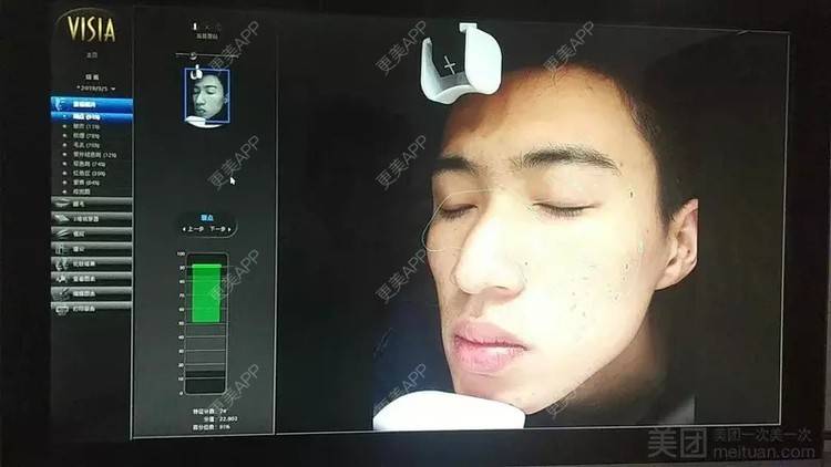 更美 - 更美用户1vAhZRoKts的果酸焕肤经验 | 重庆 | 果酸焕肤