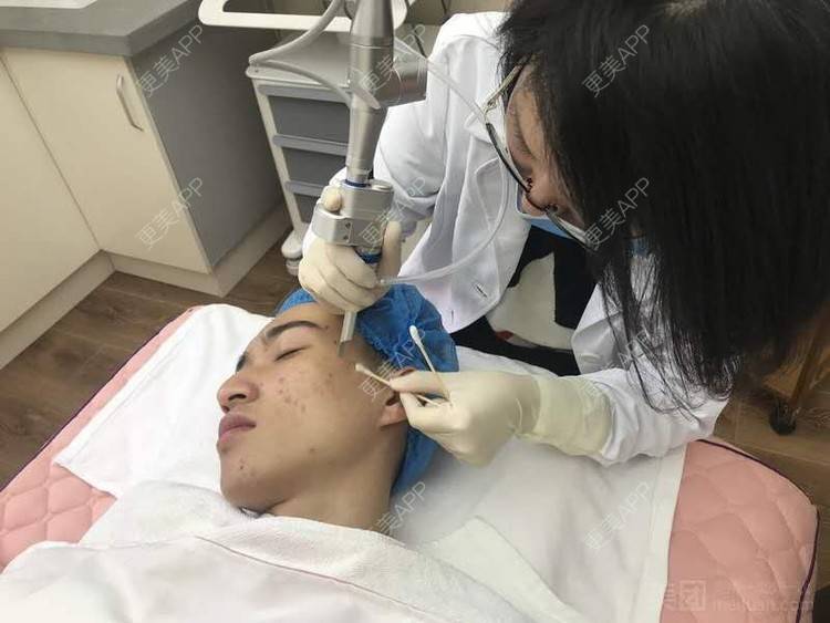 更美 - 更美用户1vAhZRoKts的果酸焕肤经验 | 重庆 | 果酸焕肤