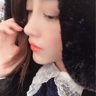 皮肤美容