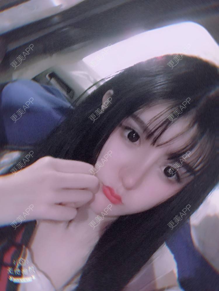 更美 - 老街上的猫的吸脂瘦脸经验 | 南昌 | 视频日记 | 吸脂瘦脸