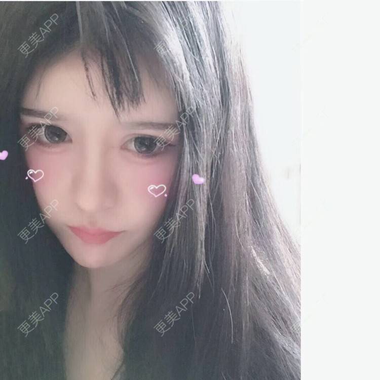 更美 - 老街上的猫的吸脂瘦脸经验 | 南昌 | 视频日记 | 吸脂瘦脸