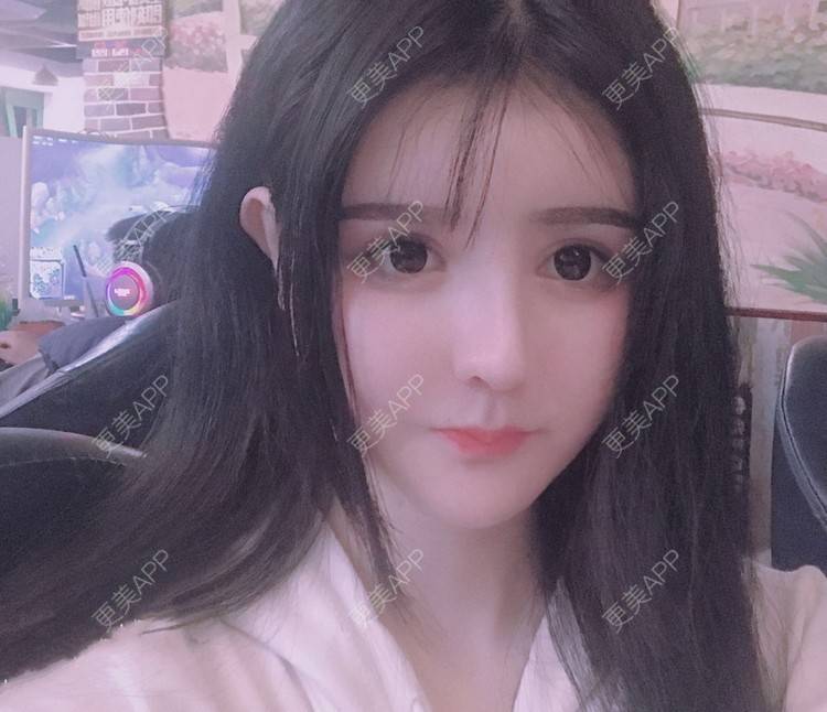 更美 - 老街上的猫的吸脂瘦脸经验 | 南昌 | 视频日记 | 吸脂瘦脸