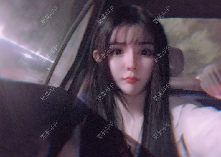 更美 - 老街上的猫的吸脂瘦脸经验 | 南昌 | 视频日记 | 吸脂瘦脸