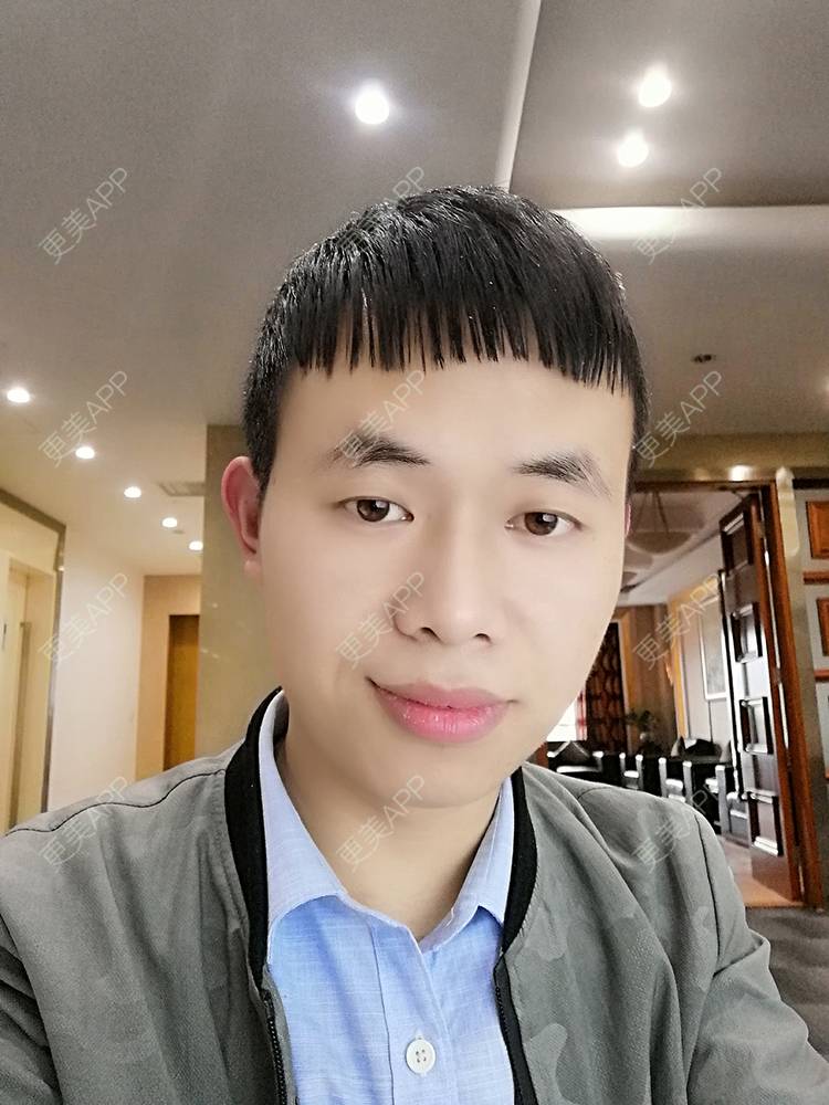 更美 - 更美用户88soGXb1A9的口腔检查经验 | 口腔检查