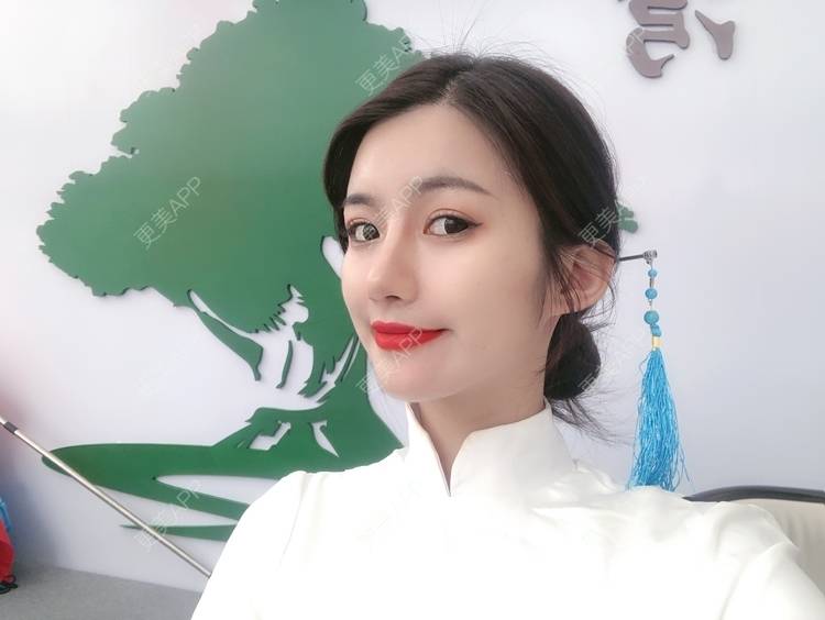 更美 - 今天可爱百分百的自体脂肪丰苹果肌经验 | 自体脂肪丰苹果肌 | 自体脂肪全面部填充 | 自体脂肪丰面颊 | 自体脂肪丰太阳穴 | 杭州 | 自体脂肪丰额头