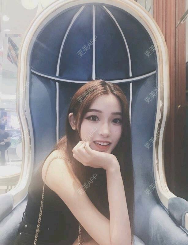 更美 - 更美用户dLTERpBpQu的果酸焕肤经验 | 佛山 | 果酸焕肤