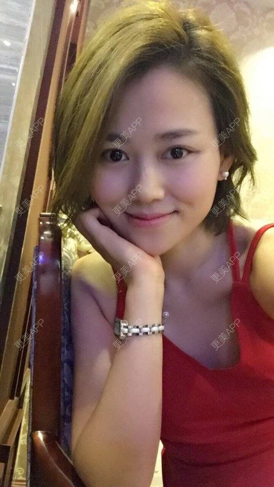 更美 - 顽固不化的假体垫苹果肌经验 | 北京 | 假体垫苹果肌