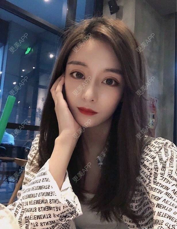 更美 - 更美用户vnGdqexJ9n的果酸焕肤经验 | 佛山 | 果酸焕肤