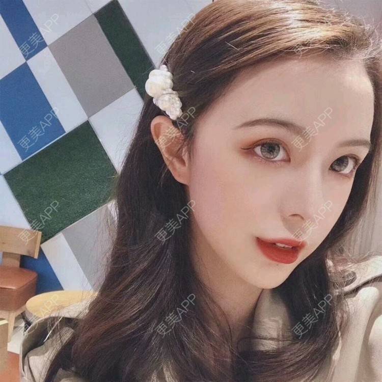 更美 - 更美用户ff8P8OV6kX的果酸焕肤经验 | 佛山 | 果酸焕肤