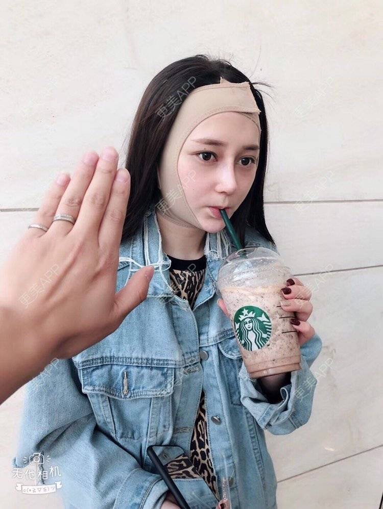 更美 - 祢的美丽/我的职责的定点双眼皮经验 | 定点双眼皮 | 肋软骨隆鼻 | 颧骨填充 | 上海