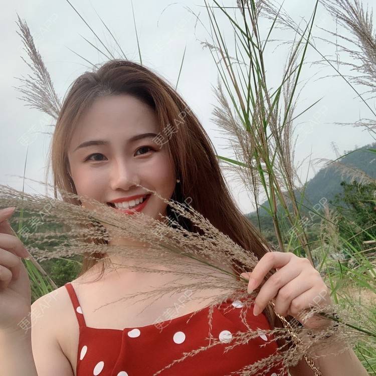 更美 - ahah的牙齿矫正经验 | 牙齿矫正 | 广州