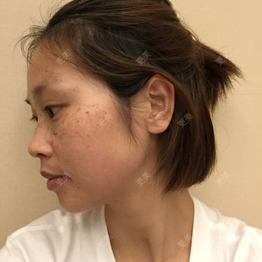 更美用户NhkfCnPZdC