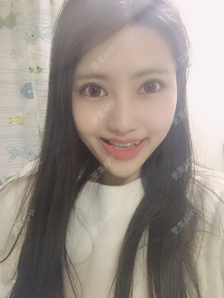 更美 - 更美用户Zxz1XIEMyn的经验 | 上海