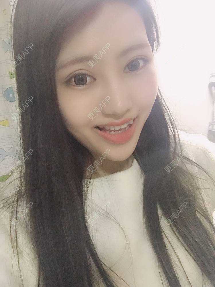 更美 - 更美用户Zxz1XIEMyn的经验 | 上海