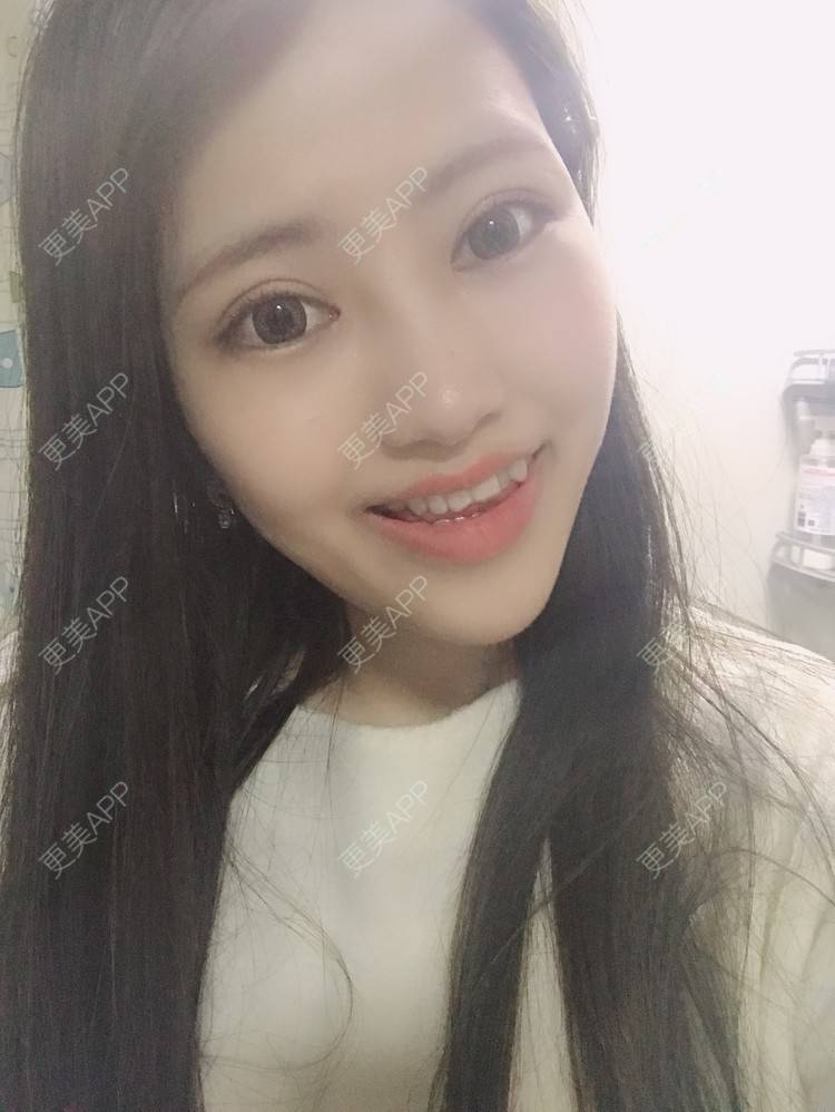 更美 - 更美用户Zxz1XIEMyn的经验 | 上海