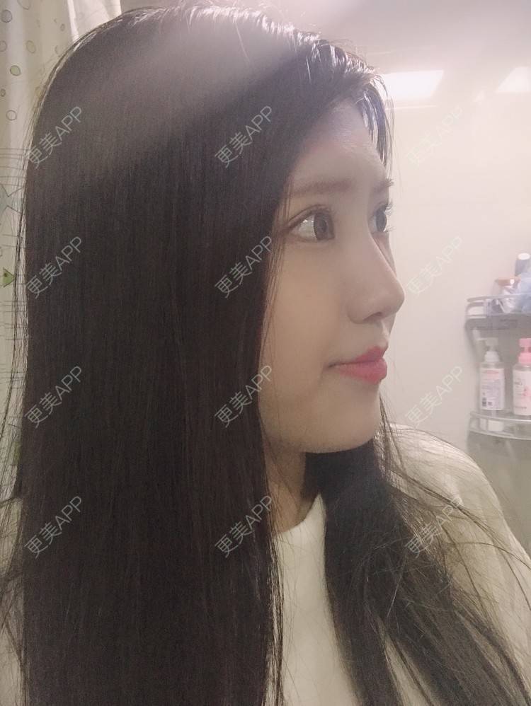 更美 - 更美用户Zxz1XIEMyn的经验 | 上海