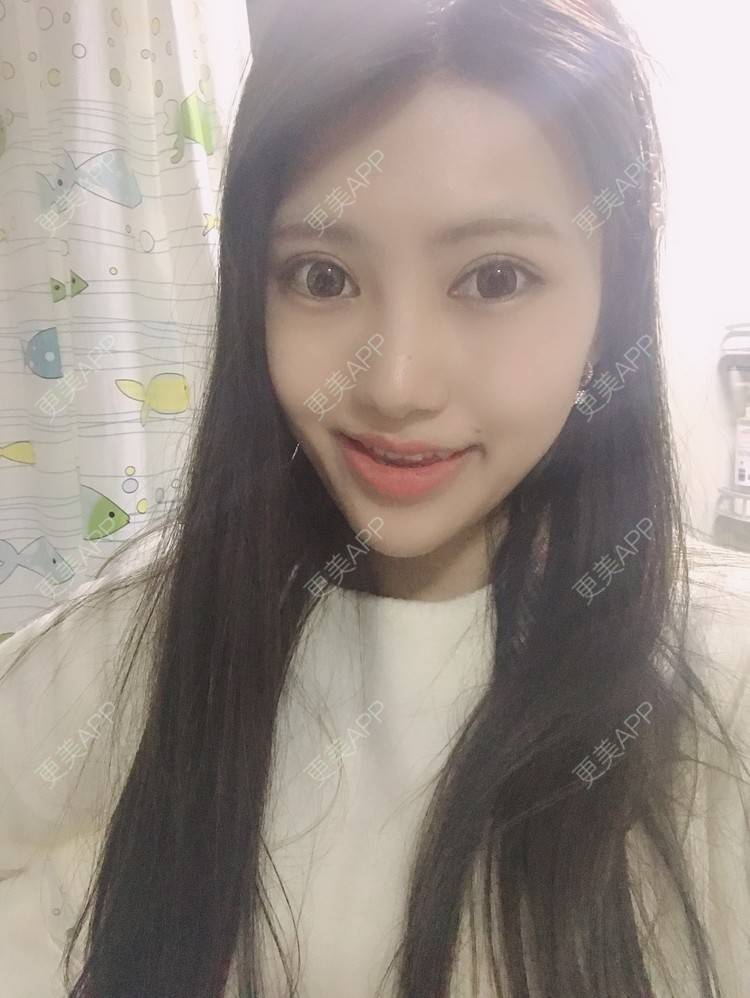 更美 - 更美用户Zxz1XIEMyn的经验 | 上海