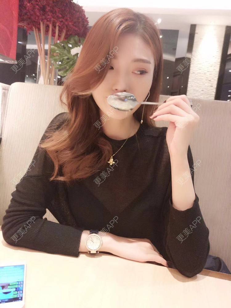 更美 - 堕精哲的玻尿酸面颊经验 | 玻尿酸面颊