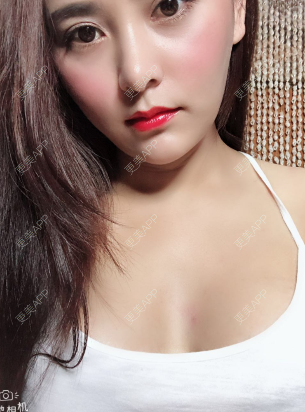 女王小姐的丰胸隆胸日记