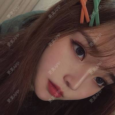 更美 - 会魔法的小仙女侣蛔的膨体隆鼻经验 | 膨体隆鼻 | 鼻部膨体假体取出 | 鼻形态修复 | 贵阳