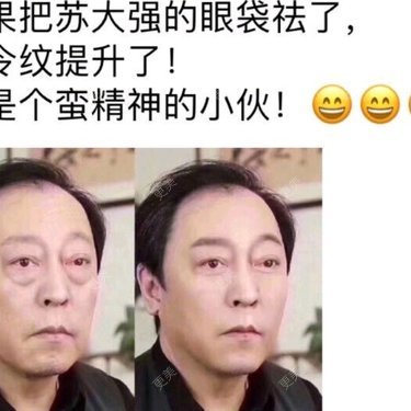 祛黑眼圈