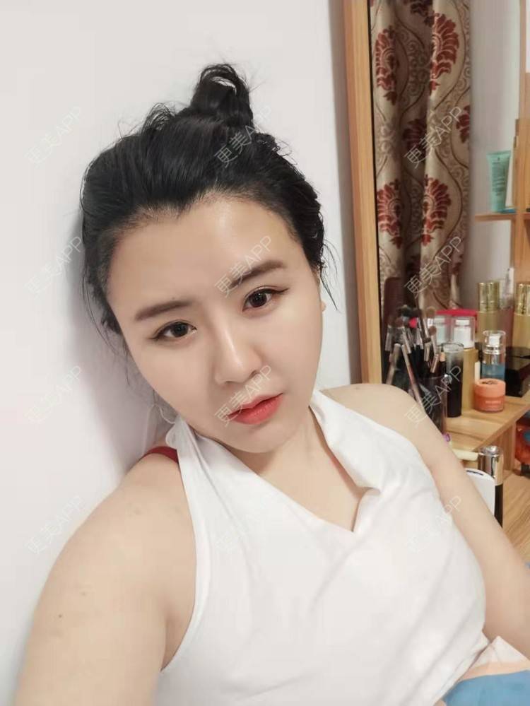 更美 - 更美用户YKZMRFxGOD的膨体垫眉弓经验 | 膨体垫眉弓 | 垫眉弓 | 武汉 | 硅胶垫眉弓