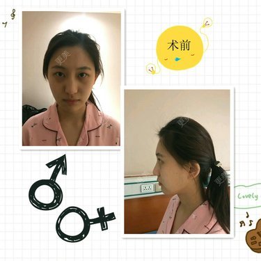 鼻部多项