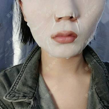 更美 - (๑乛◡乛๑)的除皱瘦脸经验 | 除皱瘦脸 | 南京